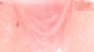 少女用扩阴器展示自己的阴道和宫颈